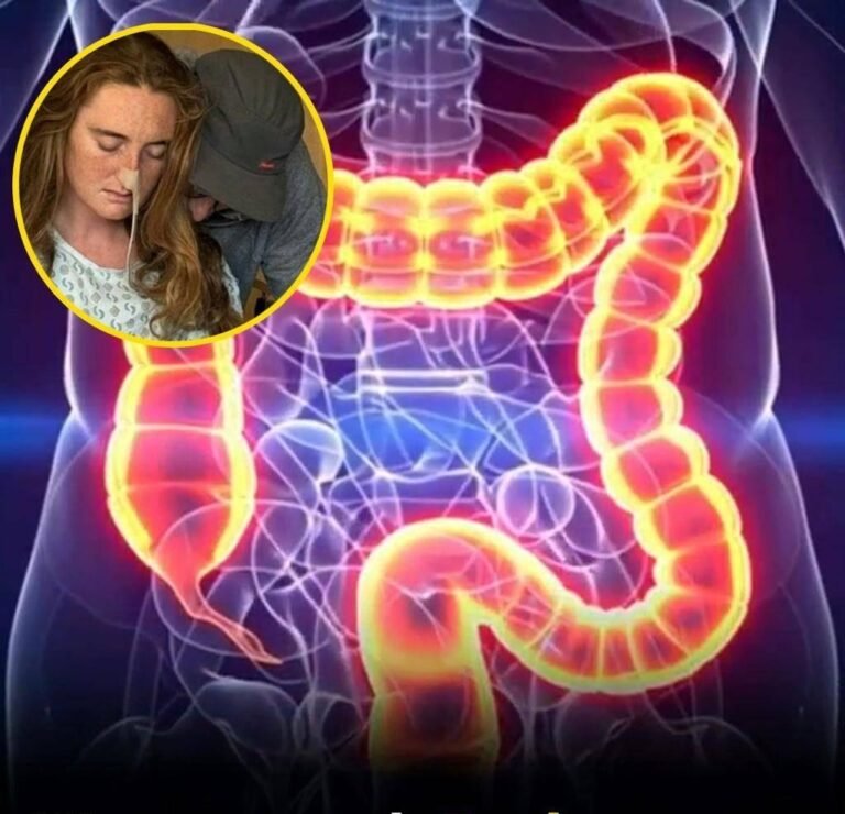 Woman reveals five colon cancer symptoms that should not be ignored