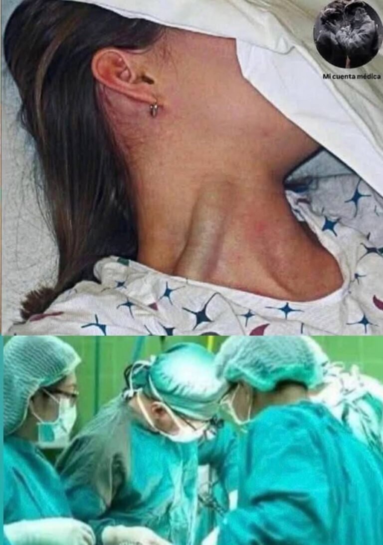 Young woman was hospitalized after being penetrated…See more