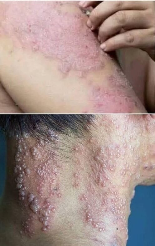 These are the consequences of sleeping with… See more