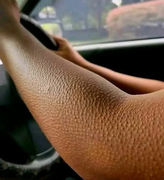 If Your Skin Looks Like This, Here’s What It Really Means