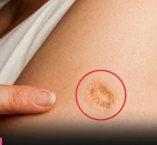 Do you have a circular mark on your arm? This reveals a historical detail that few people know.