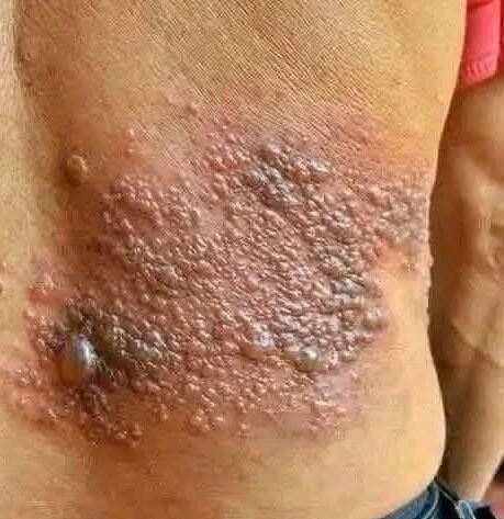 These are the consequences of sleeping with the…See more