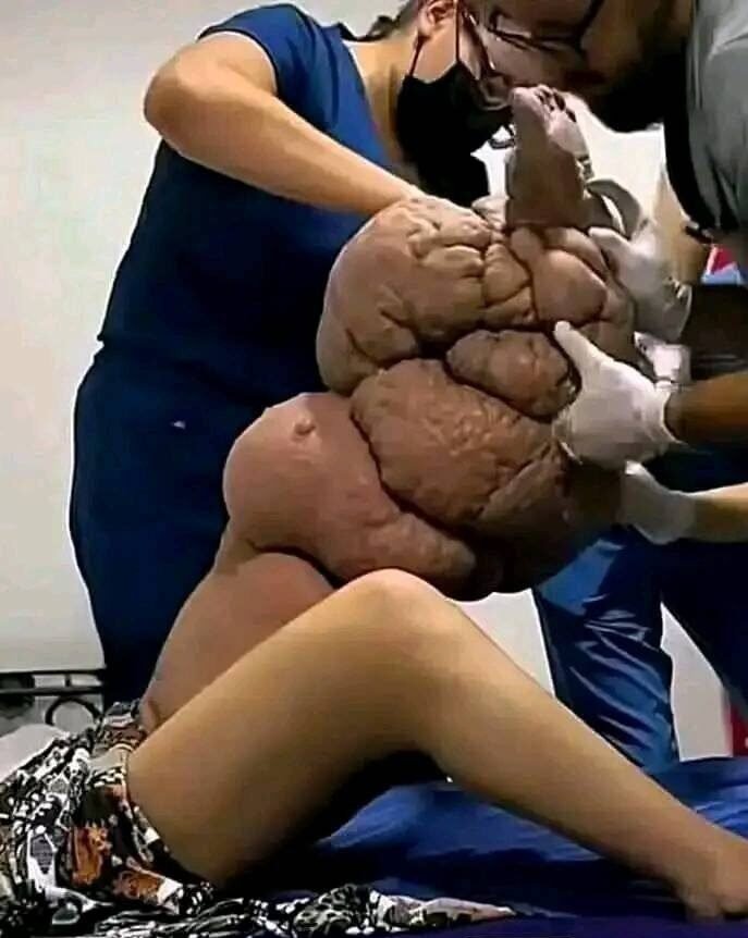 These are the causes of sleeping with a 1…See more