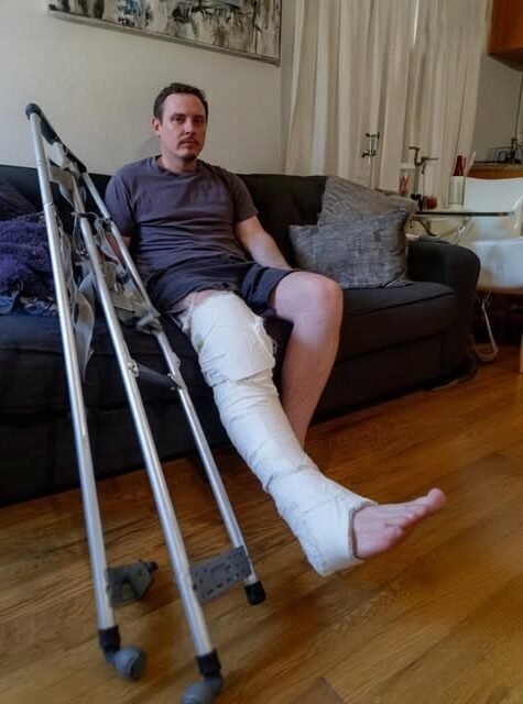 My Husband Showed Up with a Cast on His Leg the Day Before Our First Family Vacation – Then I Got a Call That Changed Everything!