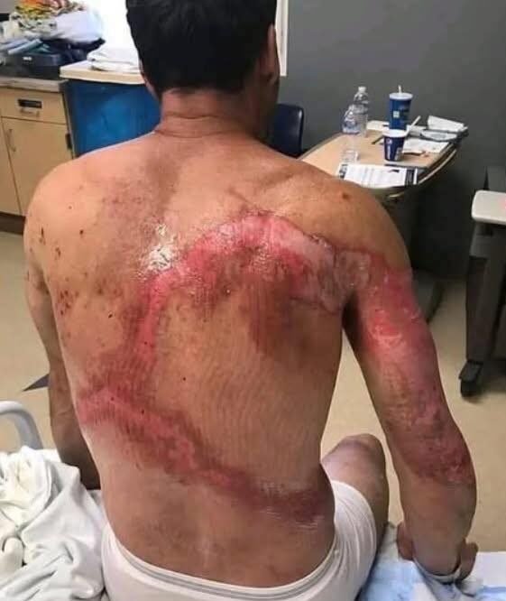 The Consequences of Sleeping With the Wrong Person