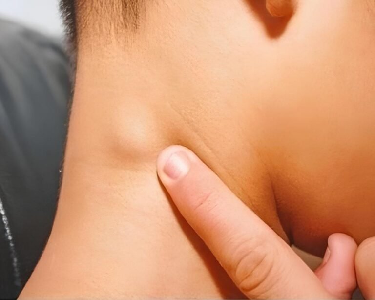 When to worry about neck lumps and what to do about them