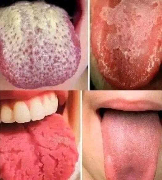 This is what your tongue says about you