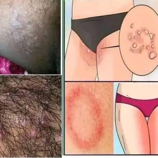 These are the signs that you are suffering from est…