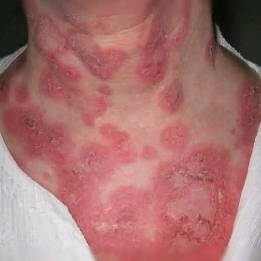 These are the consequences of sleeping with…See more