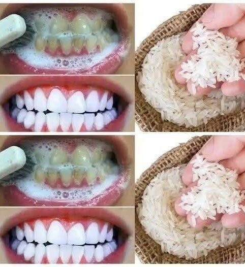 Does Rice Help Whiten Teeth? A Look at a Trending Home Method