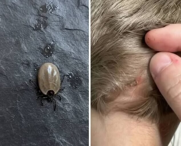 The Little Scalp Invader: What Parents Should Do When a Strange Bug Appears in Their Child’s Hair