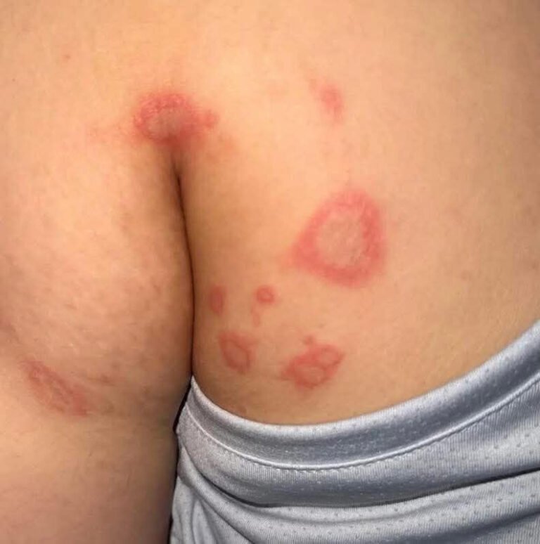 These are the consequences of sleeping with the…