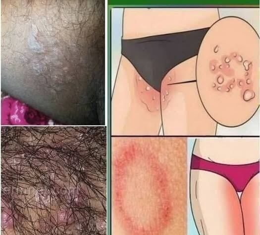 All the Symptoms of Stomach Cancer