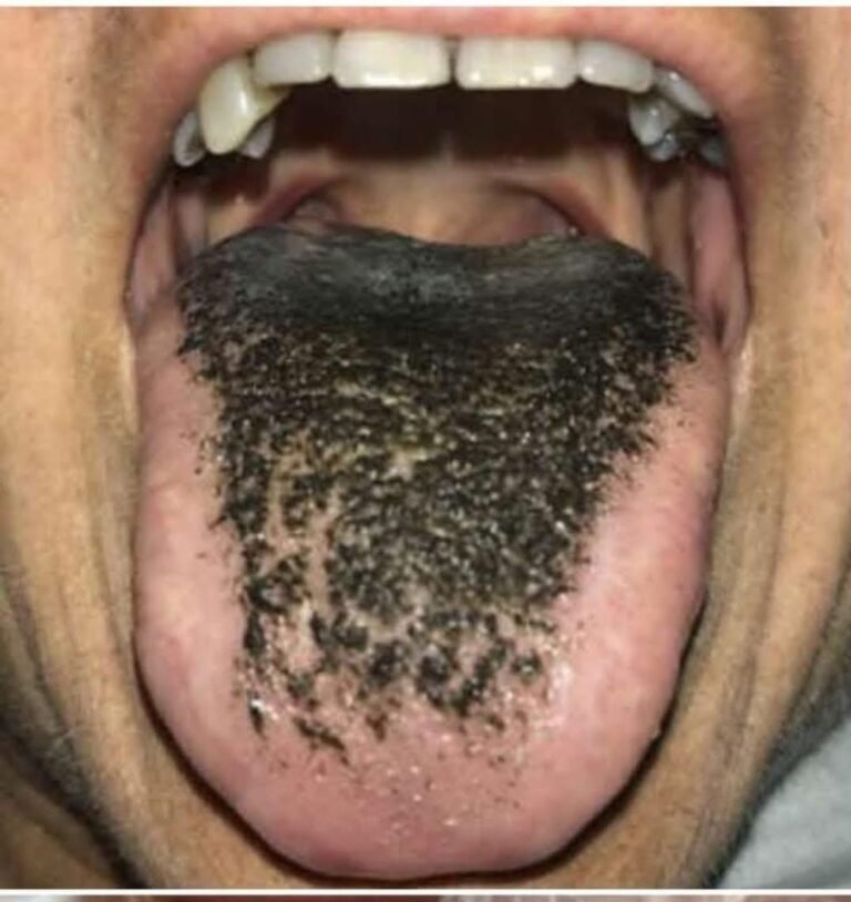 These are the consequences of sleeping with the…