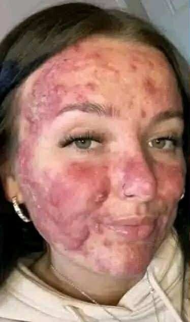 Her body was itching, I thought it was an allergy, they diagnosed ca… see more