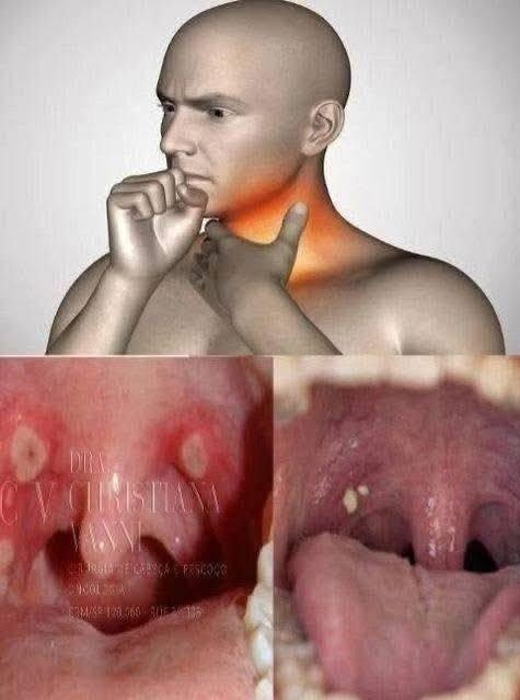 If You Have These 9 Symptoms, Get An HIV Test Immediately