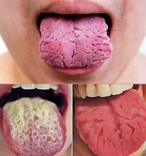 Listening to Your Body: What Tongue Changes Can Say About Overall Well-Being
