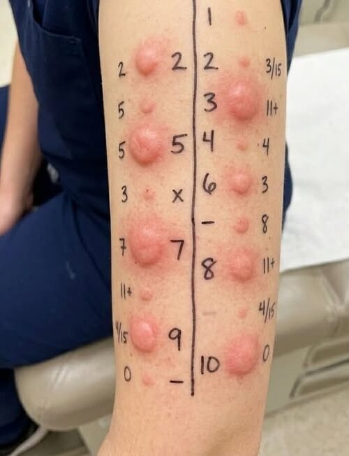 “I Noticed a Small Bump… Then I Realized How Common This Actually Is”