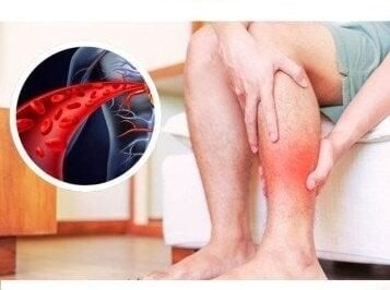 One vitamin that opens blood vessels and improves circulation