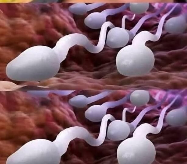 Doctors Reveal That Swallowing Leads to… See More