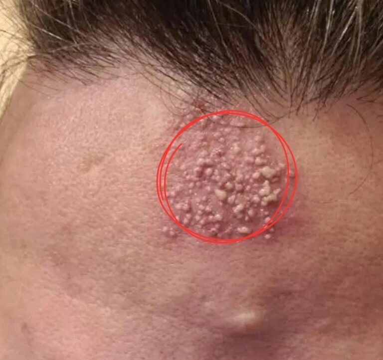 The Invisible Nightly Sabotage Why Your Lazy Bedtime Habit Is Secretly Destroying Your Skin And Risking Your Vision For Good