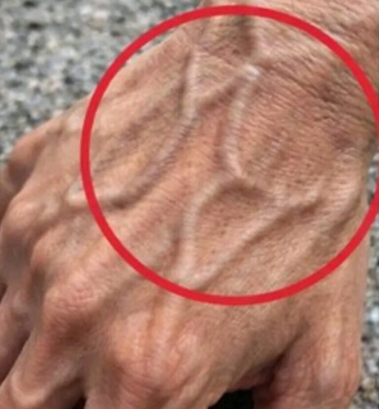 If you have visible veins, it means you are…
