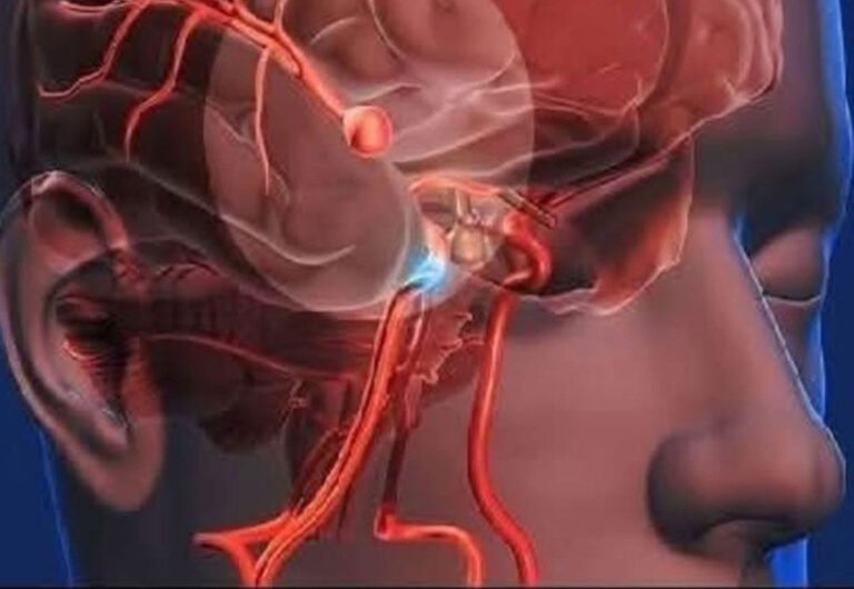 12 early warning signs of an aneurysm you shouldn’t ignore