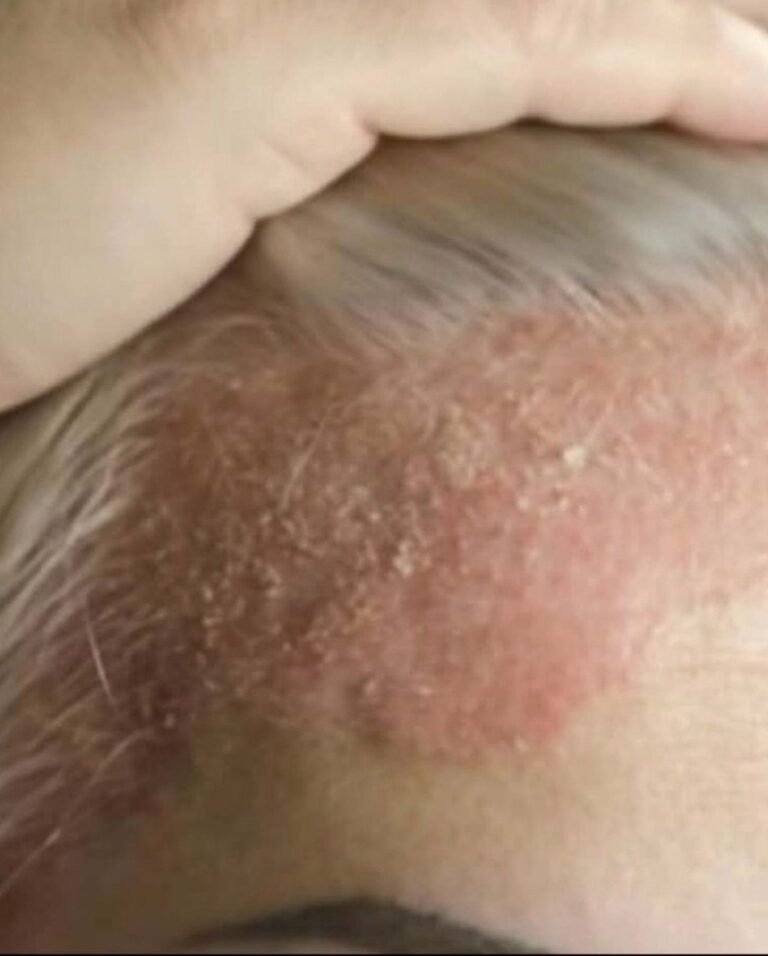 This Common Nighttime Habit Will Destroy Your Scalp And You Are Doing It Every Day