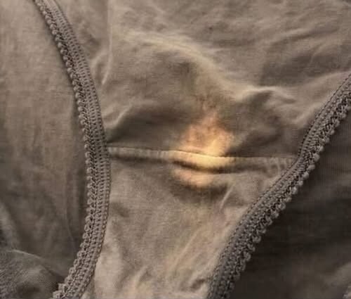 Understanding Underwear Discoloration: Normal Changes vs Health Warning Signs