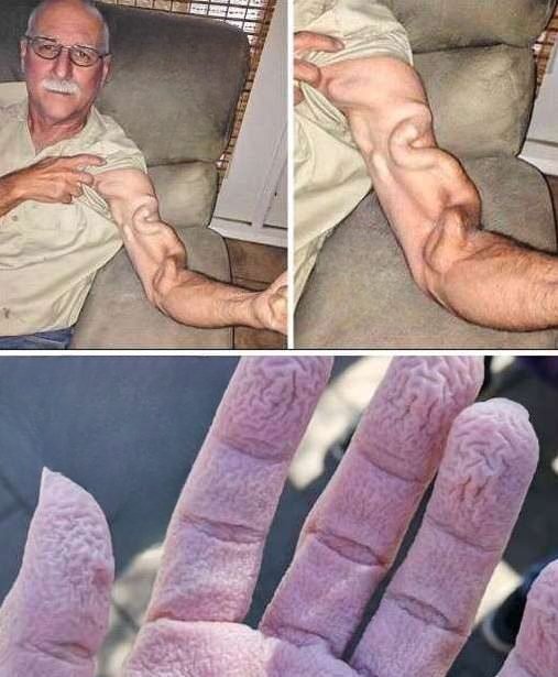 He Tried to Stretch, but Something Surprising Happened to His Arm