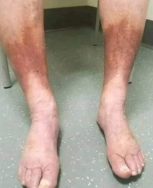 ⚠️ Warning: These Are Clear Signs Your Blood Circulation Could Be in Crisis — What Doctors Want You to Notice Early! 🩺 Secret Symptoms Many People Ignore… See more…