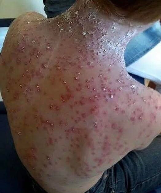 This Is the ‘Silent Disease’ That Can Develop Without You Even Realizing It — What You Should Know Before It’s Too Late