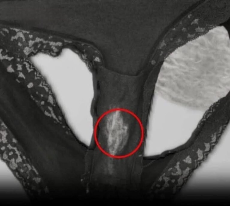 If You’ve Noticed a White Spot on Your Underwear, It Means That Your Body Is Trying to Tell You Something 👀✨